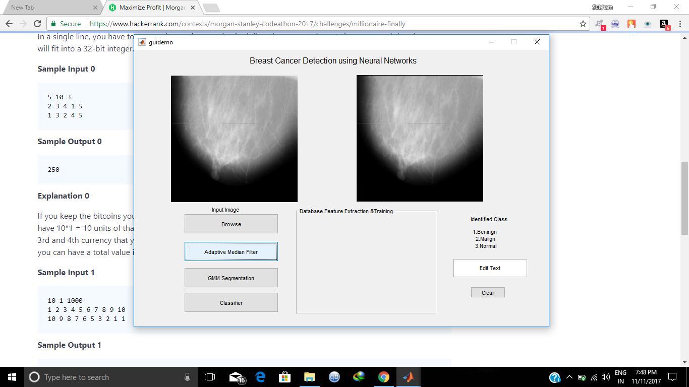 Detection Of Breast Cancer Using Neural Networks 2814